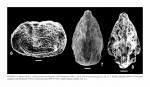 Ostracoda (seed shrimp)