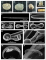 Porifera (sponges)