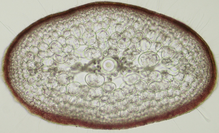 Sphaerococcus coronopifolius