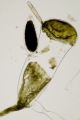 Chlorophyta (green algae)