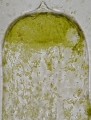 Chlorophyta (green algae)