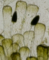 Chlorophyta (green algae)