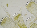 Chlorophyta (green algae)