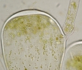 Chlorophyta (green algae)