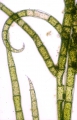 Chlorophyta (green algae)