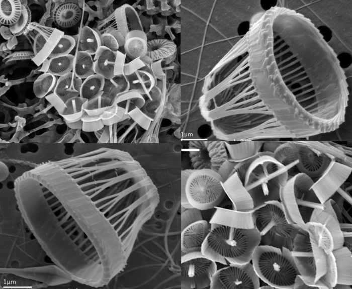 Syracosphaera winteri Keuter, Koplovitz, Zingone, J.R.Young & Frada 2021