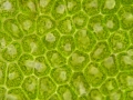 Chlorophyta (green algae)