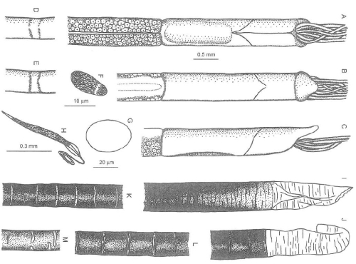 Figure 5 of Oligobrachia haakonmosbienesis by Smirnov, 2000