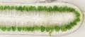 Chlorophyta (green algae)