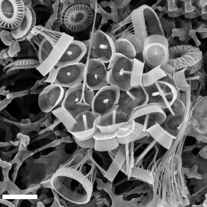 Syracosphaera winteri; scale bar 3µm; holotype - SEM