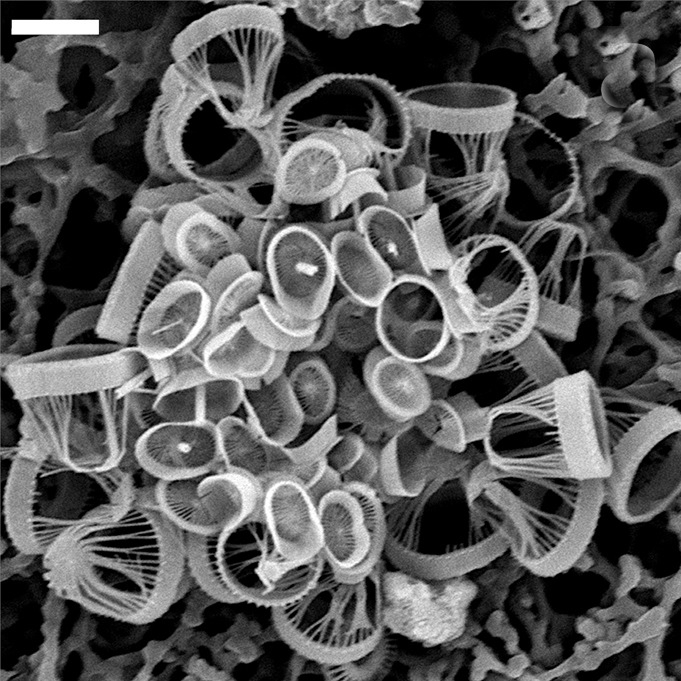 Syracosphaera winteri; scale bar 3µm - SEM