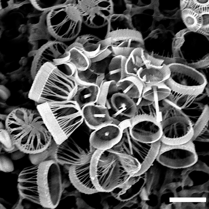 Syracosphaera winteri; scale bar 3µm - SEM