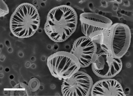 Syracosphaera winteri; scale bar 3µm - SEM