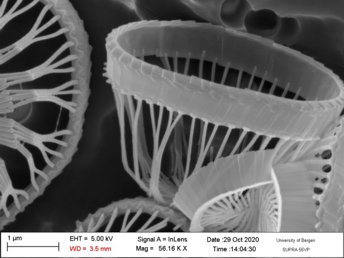 Syracosphaera sp. A - SEM Syracosphaera sp. A - SEM