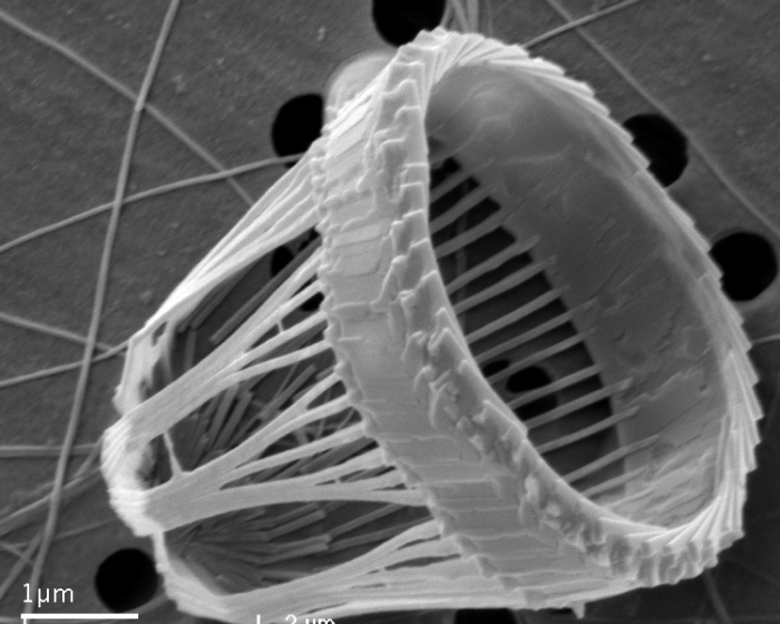 Syracosphaera sp. A - SEM Syracosphaera sp. A - SEM