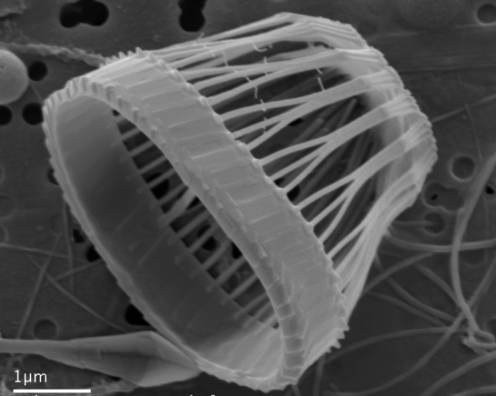 Syracosphaera sp. A - SEM Syracosphaera sp. A - SEM