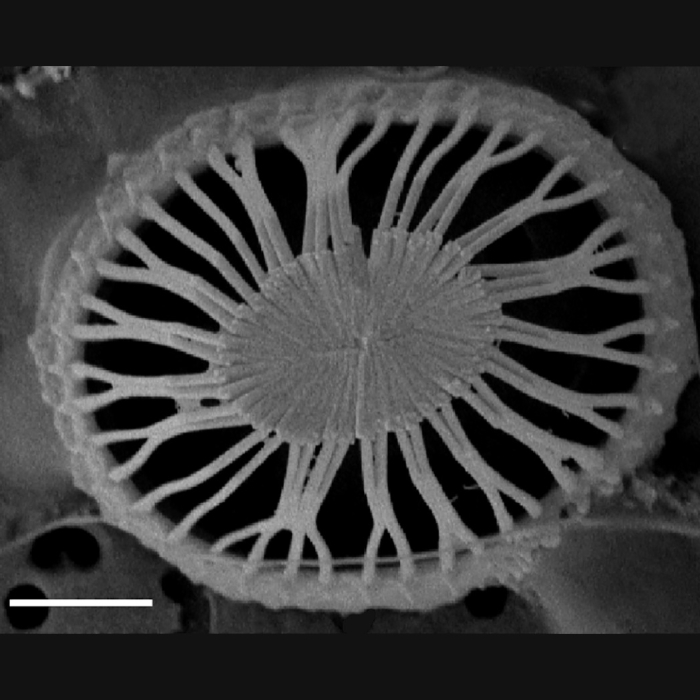 Syracosphaera winteri; scale bar 1 µm - SEM Syracosphaera winteri; scale bar 1 µm - SEM