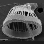 Syracosphaera winteri; an XC with a CFC inside it; scale bar 1 µm - SEM
