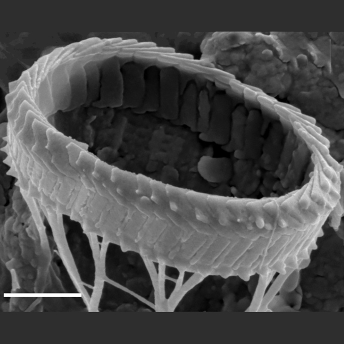 Syracosphaera winteri; slightly etched XC showing clockwise and anticlockwise imbrication of the rim; scale bar 1 µm - SEM Syracosphaera winteri; slightly etched XC showing clockwise and anticlockwise imbrication of the rim; scale bar 1 µm - SEM