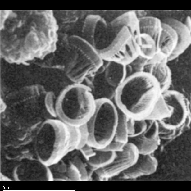 Syracosphaera sp. A.; Broken cocosphere showing ordinary caneoliths, helatoform caneoliths and exothecal cyrtoliths - SEM Syracosphaera sp. A.; Broken cocosphere showing ordinary caneoliths, helatoform caneoliths and exothecal cyrtoliths - SEM