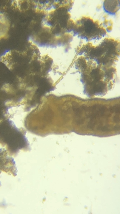 Dinophilus taeniatus Dinophilus taeniatus