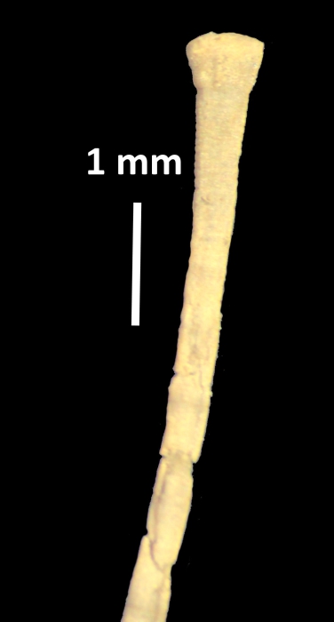 Bathycrinus gracilis Thomson, 1872, TYPE BMNH 85.3.30.33 