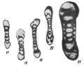 Chromista - Foraminifera (foraminifers)