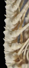 Specimen3: Proximal to midddle brachial.