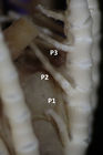 Embryometra mortenseni Gislén, 1938 Holotype Copenhagen CRI-12