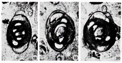 Hemigordius brunni Lys, 1980