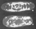 Chromista - Foraminifera (foraminifers)