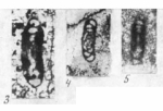 Chromista - Foraminifera (foraminifers)