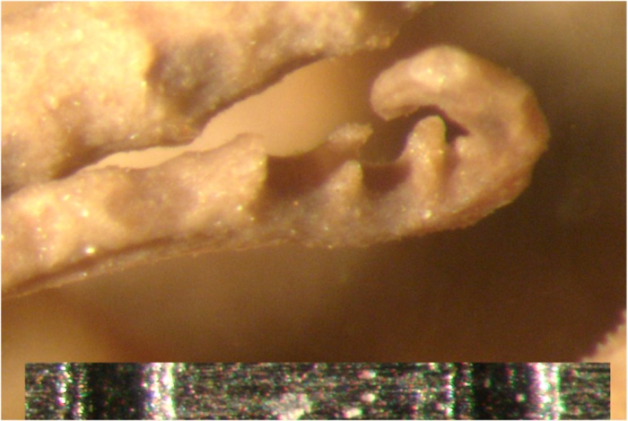 Comanthus mirabilis Rowe, Hoggett, Birtles Vail, 1986 Austral Mus Holotype J10310