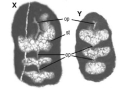 Chromista - Foraminifera (foraminifers)