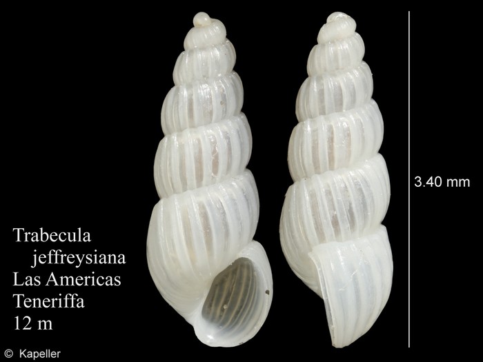 Trabecula jeffreysiana Trabecula jeffreysiana