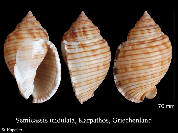 Semicassis undulata