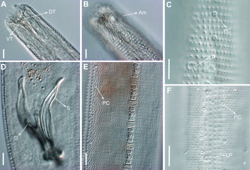 Pomponema longispiculum