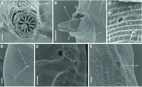 Pomponema longispiculum