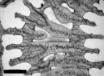 Thin section showing septothecal wall in Leptoria phrygia.