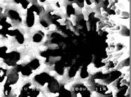 Montipora verrucosa SEm showing corallite and surrounding coenosteum