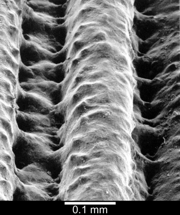 View of shallow pitted intercostal region