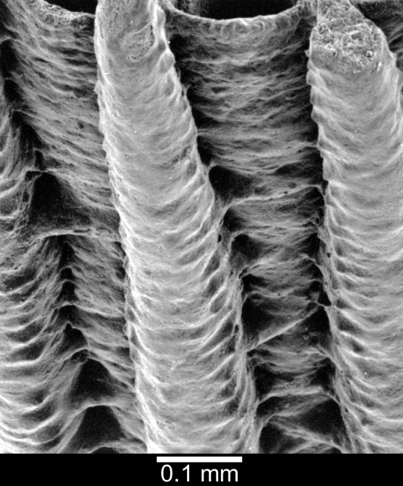 View of shallow pitted intercostal region View of shallow pitted intercostal region