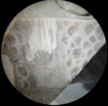 Anthozoa