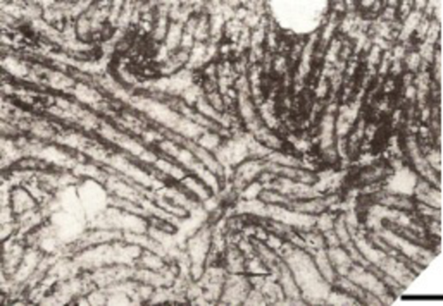 paratype of Australoseris radialis Morsch