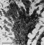 holotype of Garateastrea bardanegrensis Morsch