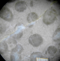 Anthozoa