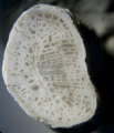 Anthozoa