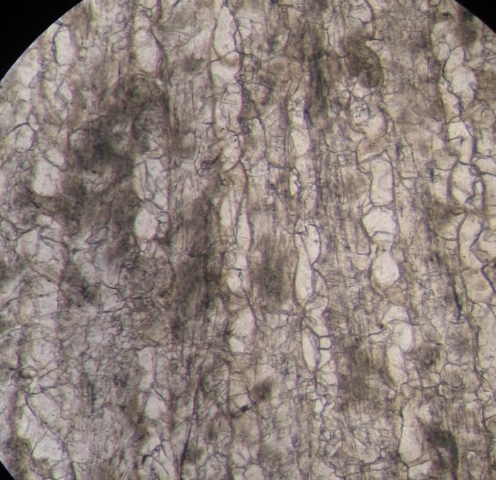 Holotype of Ovalastreopsis soaravikelyensis type species of the genus Holotype of Ovalastreopsis soaravikelyensis type species of the genus