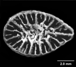 Placotrochides scaphula , Holotype, calicular view (anthocyathus)