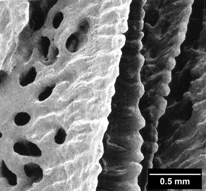Balanophyllia (E.) caribbeana, detail of axial edges Balanophyllia (E.) caribbeana, detail of axial edges